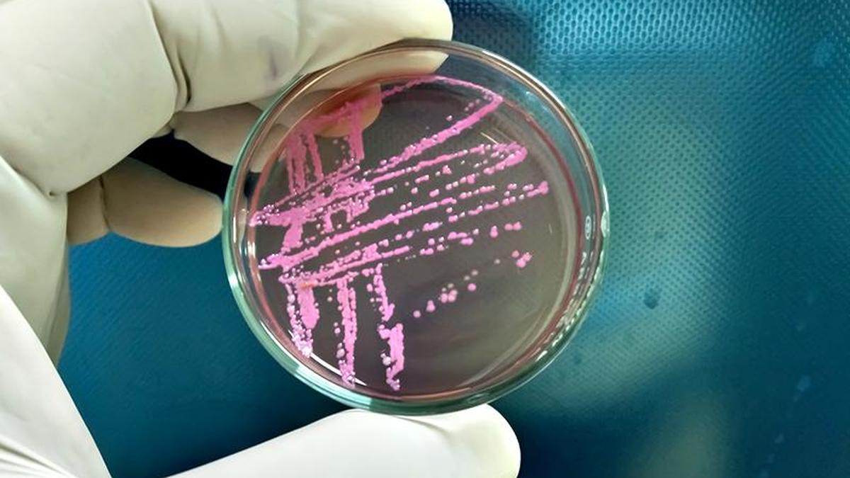 Shigella | Virulent bacterium